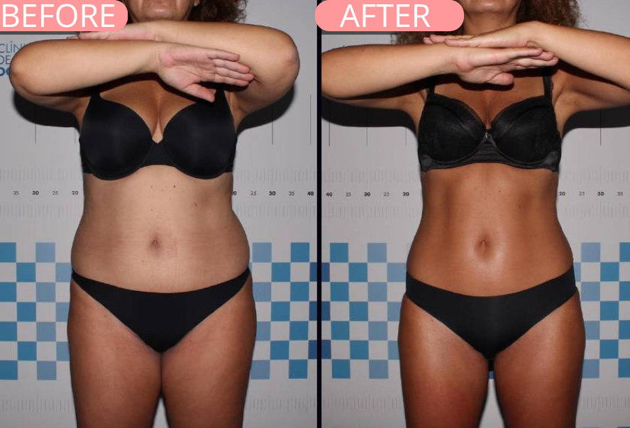 Final Before and After